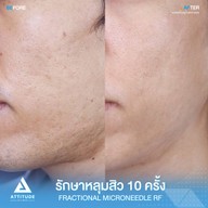 เมนูของร้าน Attitude Clinic  ห้วยขวาง
