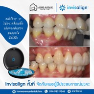 คลินิกทันตกรรมโฮมอเวนิว