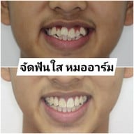 คลินิกทันตกรรมโฮมอเวนิว