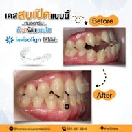 คลินิกทันตกรรมโฮมอเวนิว