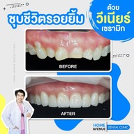 คลินิกทันตกรรมโฮมอเวนิว