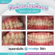 คลินิกทันตกรรมโฮมอเวนิว