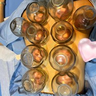 ศรีริกุลคลินิกแพทย์แผนจีน ฝังเข็ม ครอบแก้ว ยาจีน พิษณุโลก