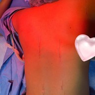 ศรีริกุลคลินิกแพทย์แผนจีน ฝังเข็ม ครอบแก้ว ยาจีน พิษณุโลก