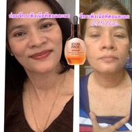 เมนูของร้าน อาจารย์จันนาชลบุรี กำจัดไฝตามโหงวเฮ้ง ขี้แมลงวัน ติ่งเนื้อ เลเซอร์ สมุนไพร สี่แยกพลับพลา เสม็ดชลบุรี