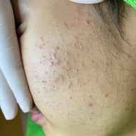 ร้านนวดหน้าด้วยมือ ที่เดียวในลำปาง อายตานิคสาขาเมืองลำปาง