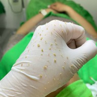 ร้านนวดหน้าด้วยมือ ที่เดียวในลำปาง อายตานิคสาขาเมืองลำปาง