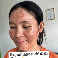 ร้านนวดหน้าด้วยมือ ที่เดียวในลำปาง อายตานิคสาขาเมืองลำปาง