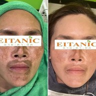 ร้านนวดหน้าด้วยมือ ที่เดียวในลำปาง อายตานิคสาขาเมืองลำปาง