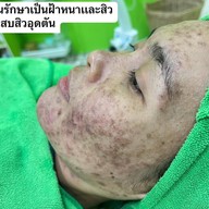 ร้านนวดหน้าด้วยมือ ที่เดียวในลำปาง อายตานิคสาขาเมืองลำปาง