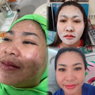 ร้านนวดหน้าด้วยมือ ที่เดียวในลำปาง อายตานิคสาขาเมืองลำปาง