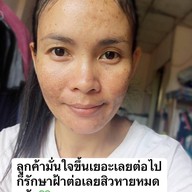 ร้านนวดหน้าด้วยมือ ที่เดียวในลำปาง อายตานิคสาขาเมืองลำปาง