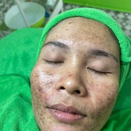 ร้านนวดหน้าด้วยมือ ที่เดียวในลำปาง อายตานิคสาขาเมืองลำปาง