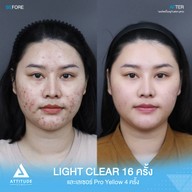 เมนูของร้าน ATTITUDE CLINIC เชียงราย