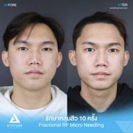 เมนูของร้าน Attitude Clinic  ห้วยขวาง