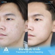 เมนูของร้าน Attitude Clinic  ห้วยขวาง