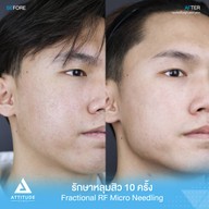 เมนูของร้าน Attitude Clinic  ห้วยขวาง