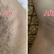 La Nature Chiangmai Waxing เชียงใหม่