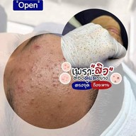 พี่กุ้งกดสิวสาขาโกสุมรวมใจ กดสิวดอนเมือง