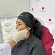 Teerak Clinic ที่รักคลินิก ขอนแก่น ฟิลเลอร์ โบท็อกซ์ ร้อยไหม ความงาม ขอนแก่น