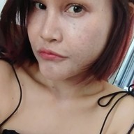 Teerak Clinic ที่รักคลินิก ขอนแก่น ฟิลเลอร์ โบท็อกซ์ ร้อยไหม ความงาม ขอนแก่น