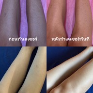 เมนูของร้าน De LUNA Clinic ศรีนครินทร์