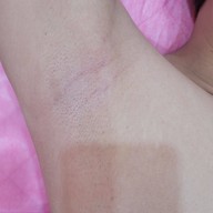 De LUNA Clinic ศรีนครินทร์