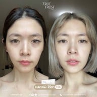 TrueTrust Clinic รามอินทรา