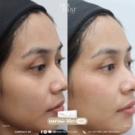 TrueTrust Clinic รามอินทรา