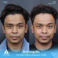 เมนูของร้าน Attitude Clinic  ห้วยขวาง