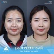 เมนูของร้าน ATTITUDE CLINIC เชียงราย