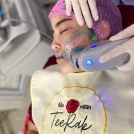 Teerak Clinic ที่รักคลินิก ขอนแก่น ฟิลเลอร์ โบท็อกซ์ ร้อยไหม ความงาม ขอนแก่น