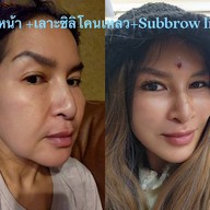 เมนูของร้าน MAXi Cosmetic Surgery