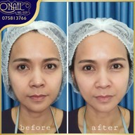 O'nail Nail&body เมืองกระบี่