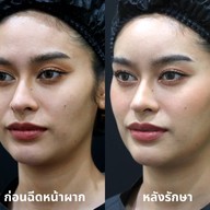 AIC Clinic พระราม 4