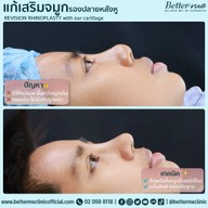 Better Me Clinic by Dr. Chanya