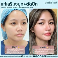 Better Me Clinic by Dr. Chanya