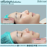 Better Me Clinic by Dr. Chanya