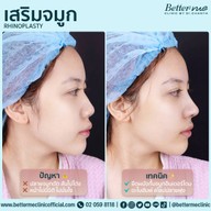 Better Me Clinic by Dr. Chanya