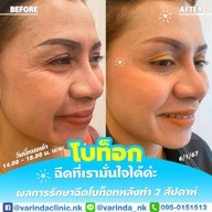 วรินดาคลินิก หนองแขม