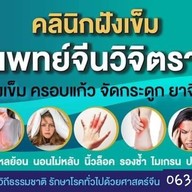 แพทย์จีนวิจิตรา ฝังเข็ม ครอบแก้ว รักษาโรคด้วยศาสตร์จีน