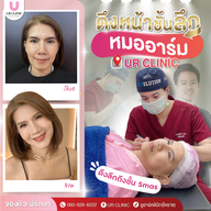 ยูอาร์คลินิก หมออาร์ม โคราช UR Clinic ดึงหน้า แก้หนังตาตก ตัดถุงใต้ตา ตัดเหนียง ตาสองชั้น ดูดไขมัน โคราช