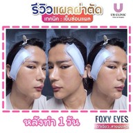 ยูอาร์คลินิก หมออาร์ม โคราช UR Clinic ดึงหน้า แก้หนังตาตก ตัดถุงใต้ตา ตัดเหนียง ตาสองชั้น ดูดไขมัน โคราช