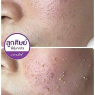 เมนูของร้าน พี่กุ้งกดสิวเชียงใหม่ มช.เชียงใหม่