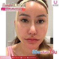 ยูอาร์คลินิก หมออาร์ม โคราช UR Clinic ดึงหน้า แก้หนังตาตก ตัดถุงใต้ตา ตัดเหนียง ตาสองชั้น ดูดไขมัน โคราช