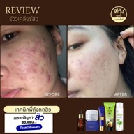 เมนูของร้าน พี่กุ้งกดสิวเชียงใหม่ มช.เชียงใหม่