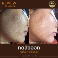 เมนูของร้าน พี่กุ้งกดสิวเชียงใหม่ มช.เชียงใหม่