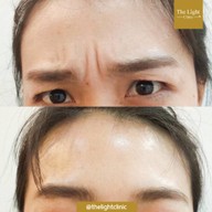 เมนูของร้าน The Light Clinic เดอะไลท์คลินิก