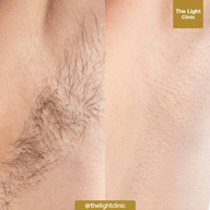 เมนูของร้าน The Light Clinic เดอะไลท์คลินิก