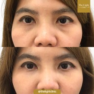เมนูของร้าน The Light Clinic เดอะไลท์คลินิก